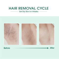 Laser IPL Hair Removal - At Home Laser Hair Removal System
